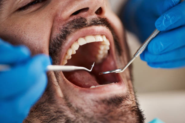 Best Emergency Denture Repair in Rushville, IN